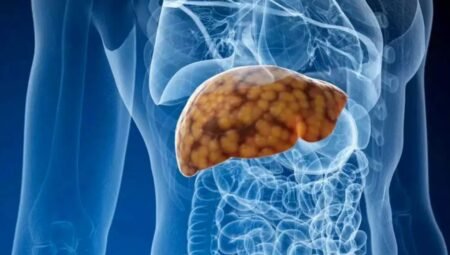 Karaciğer yağlanmasında sıvı şeker uyarısı: Çin’de 15 binden fazla kişiyle yapılan çalışma içecek tüketimine dikkat çekti