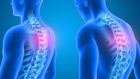 Kifoz nedir, belirtileri nelerdir? Uzman açıklamalarına göre kamburlukta erken teşhis neden önemli