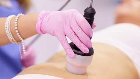 Radyofrekans tedavisi nedir? 2026’da ameliyatsız ağrı tedavisinin tüm detayları