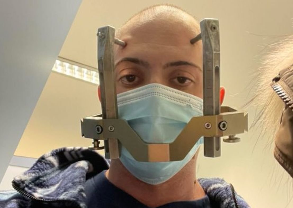 Ameliyatsız beyin lezyonu tedavisi: Gamma Knife ile aynı gün eve dönmek mümkün